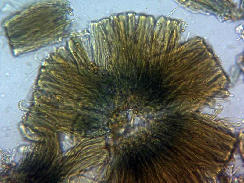 Bacidia rubella 10 - Himenio Melzer x 400 1